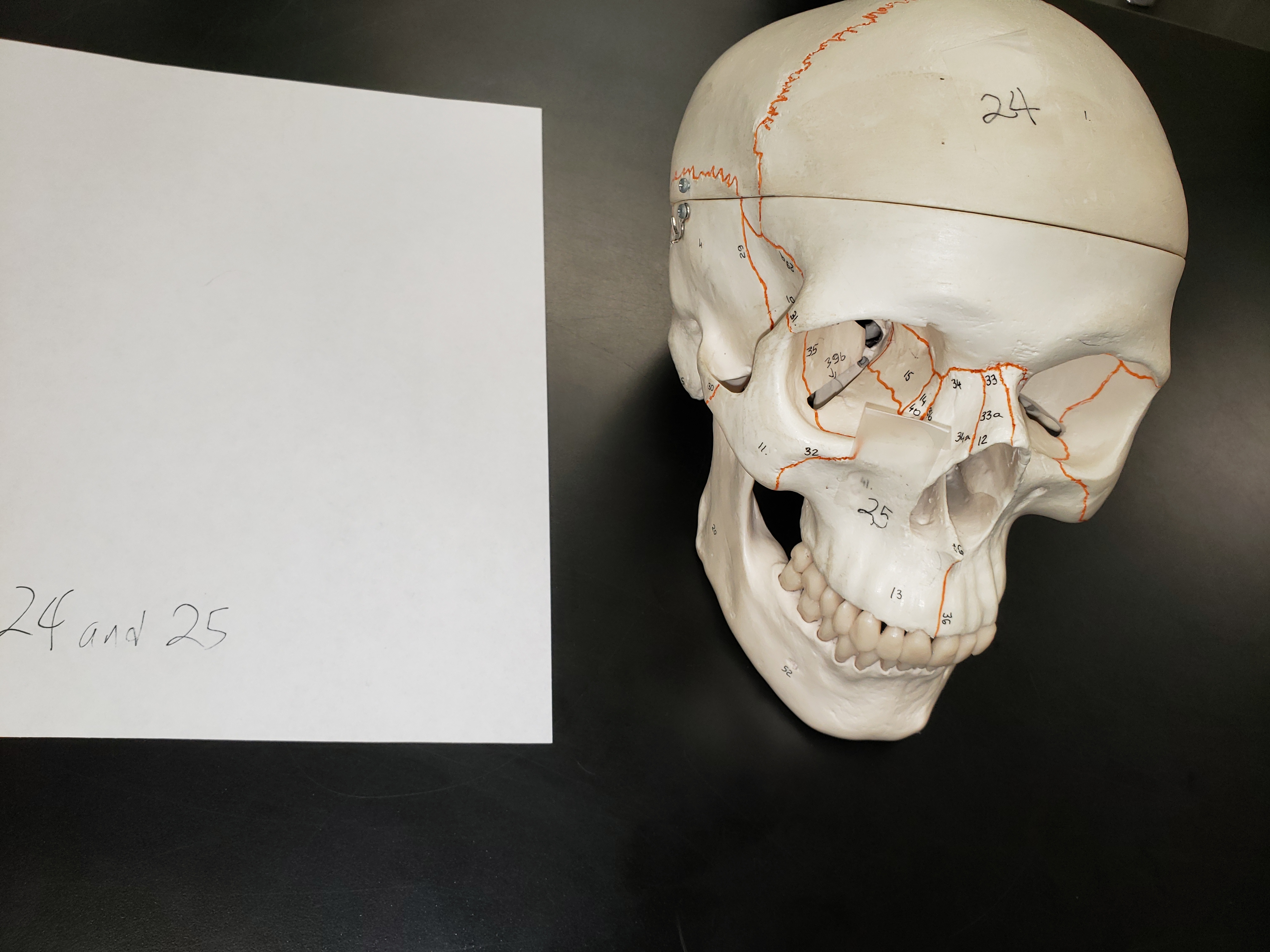 skull face labeled