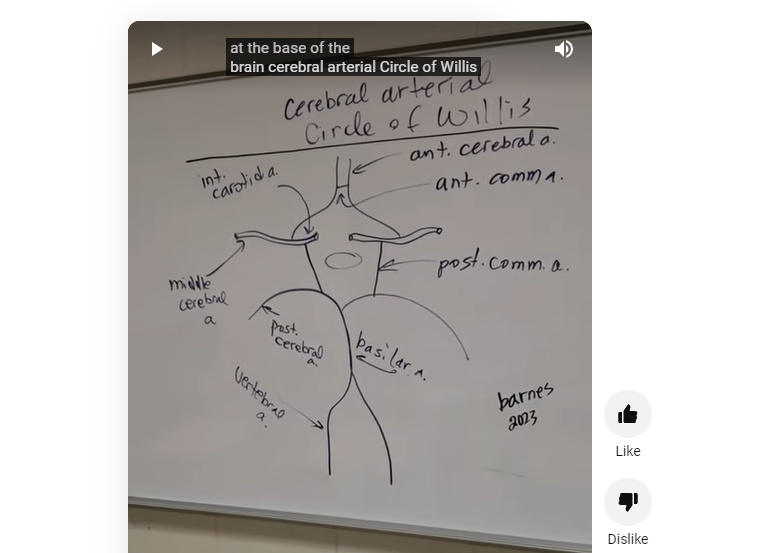 Drawing the cerebral arterial circle of Willis with printable companion ...